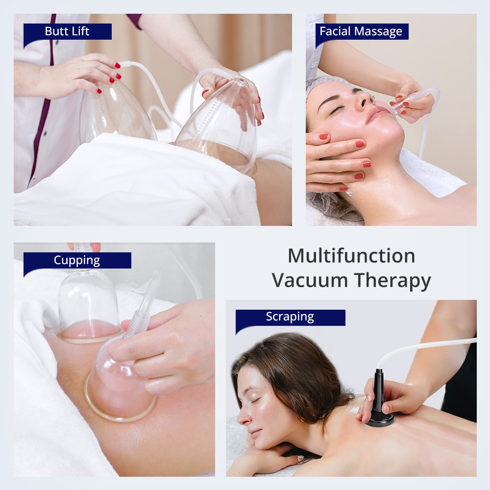 BBL 150ml Cups Breast Butt Enlargement Machine Body Massage Cupping Therapy USA