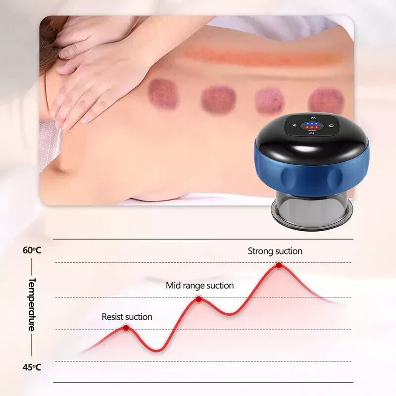 Speed Smart Electric Cupping Therapy Machine with USB Charging & Vacuum Suction