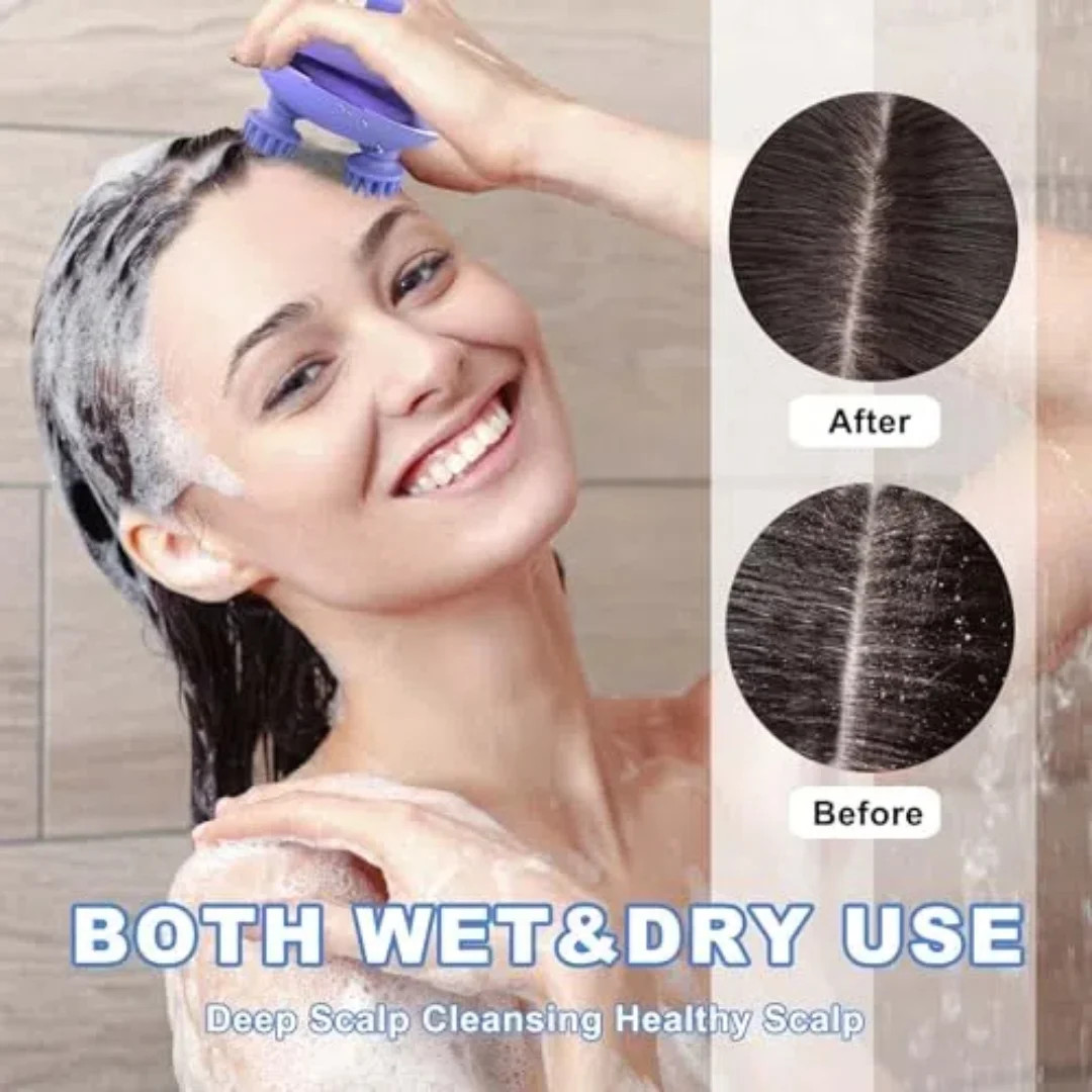 Scalp Massager Portable Electric Scalp Massager Hair Growth,Waterproof Handheld