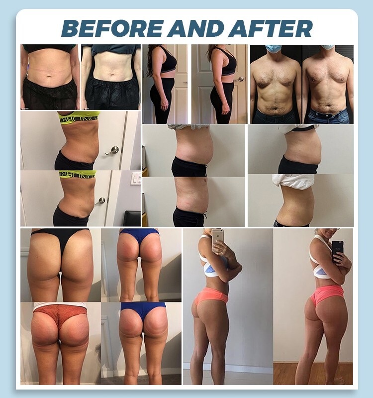 2025 myoslim Body Shaping Fat Removal Build Muscles Machine Sculpt Salon Machine