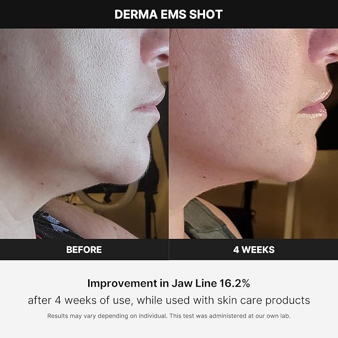 1Pcs Face Skin Tightening Massage Beauty Machine Anti-Wrinkle Anti-Aging Device